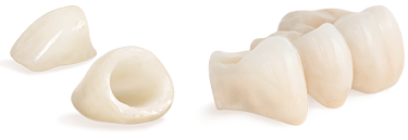 Palatine Dental Crowns and Bridges